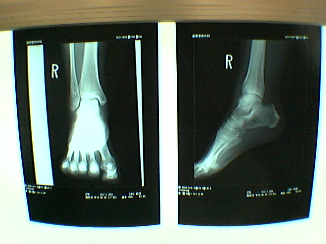 X-ray0802-charlie