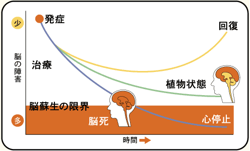 植物 状態 脳死